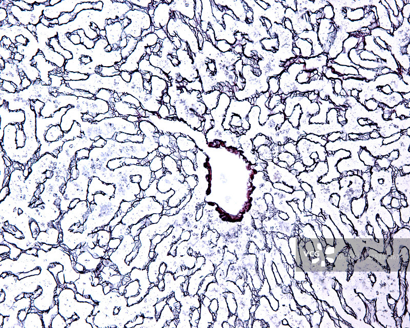 肝小叶显微照片图片素材