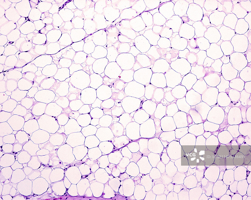 脂肪组织，光学显微照片图片素材