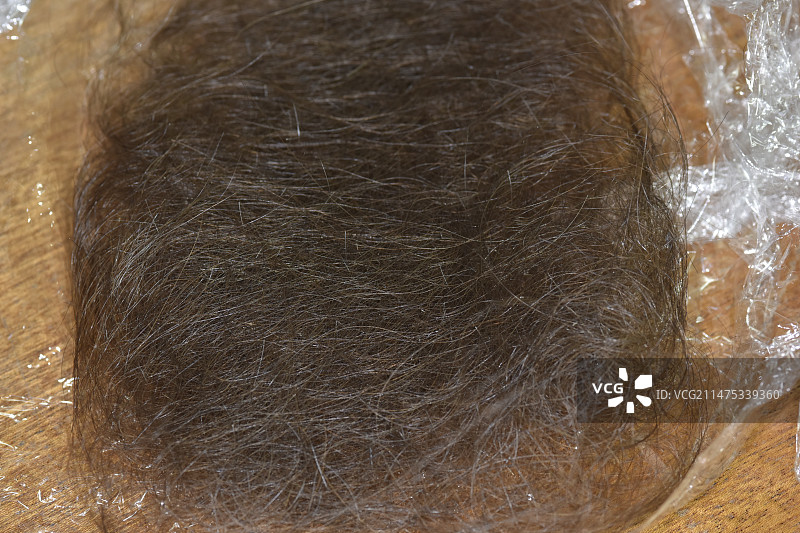 斑秃引起的脱发图片素材