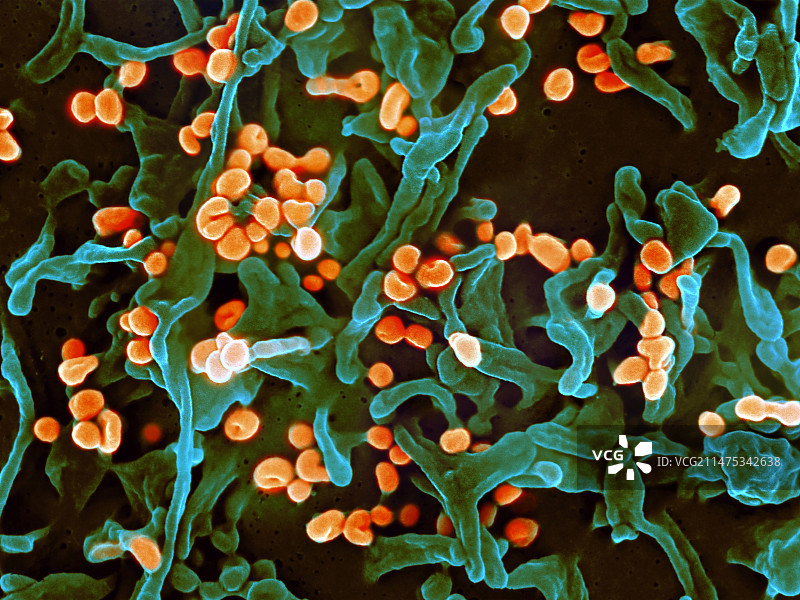 拉沙病毒出芽扫描电镜图图片素材