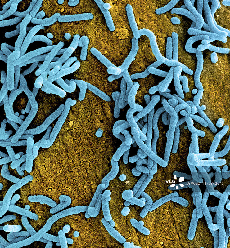 马尔堡病毒图片素材