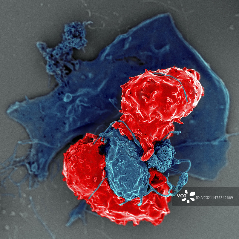 调节性T细胞，扫描电镜图片素材