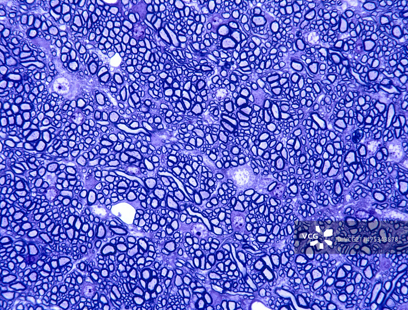 脑部显微照片图片素材