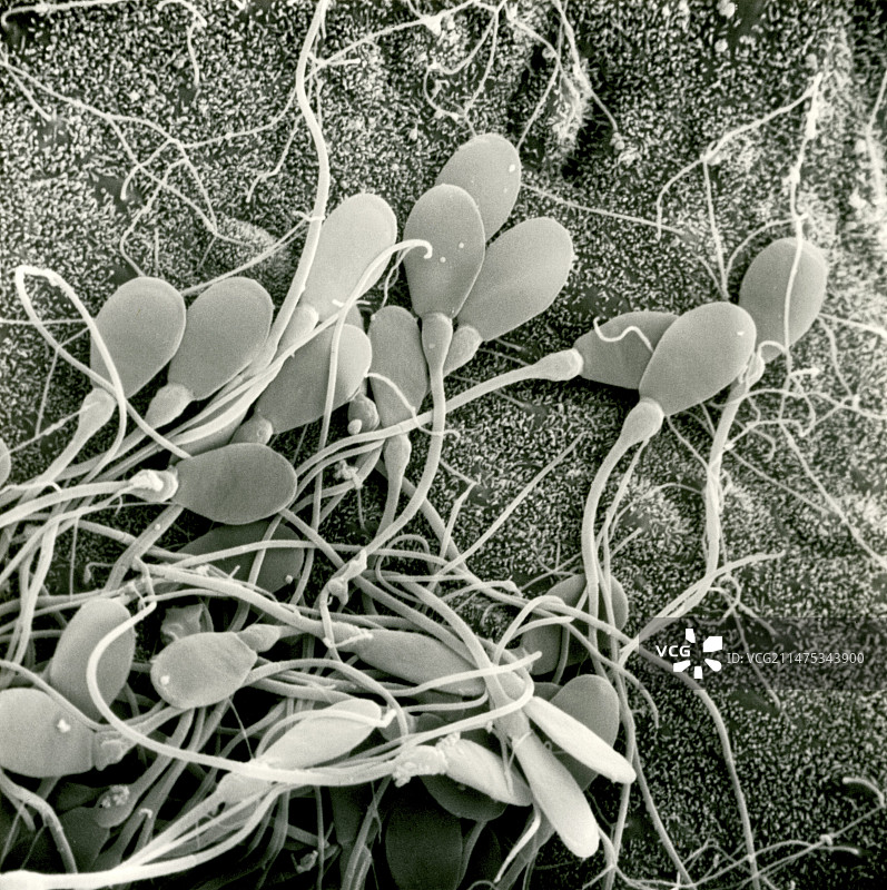 精子，扫描电镜图片素材