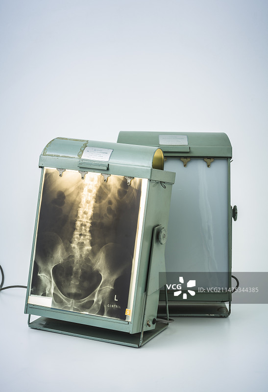 20世纪的X光片观片灯箱图片素材