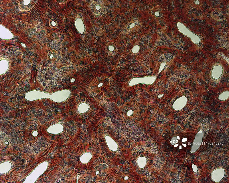 骨骼结构显微照片图片素材