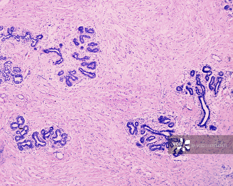 人类乳腺导管，光学显微照片图片素材