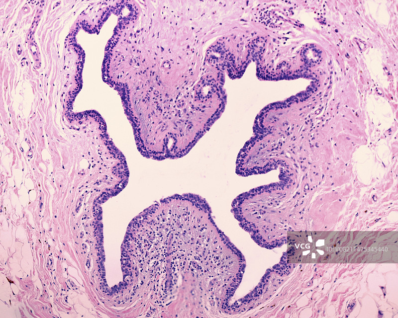 人类乳腺导管，光学显微照片图片素材