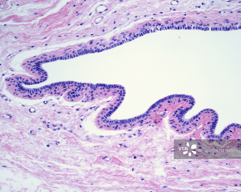 人类乳腺导管，光学显微照片图片素材