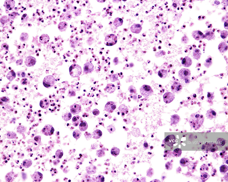 卵巢细胞凋亡显微照片图片素材
