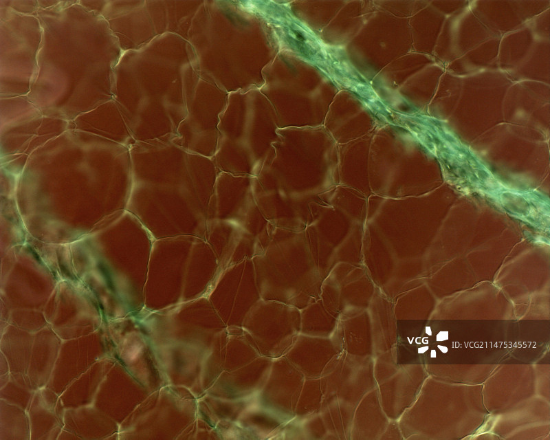 白色脂肪组织显微照片图片素材