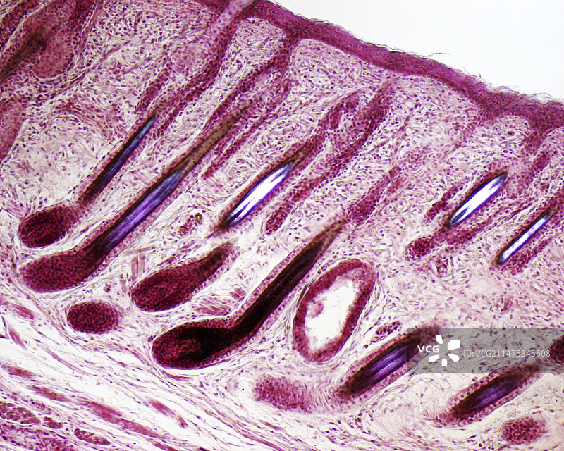 皮肤组织和毛囊显微照片图片素材