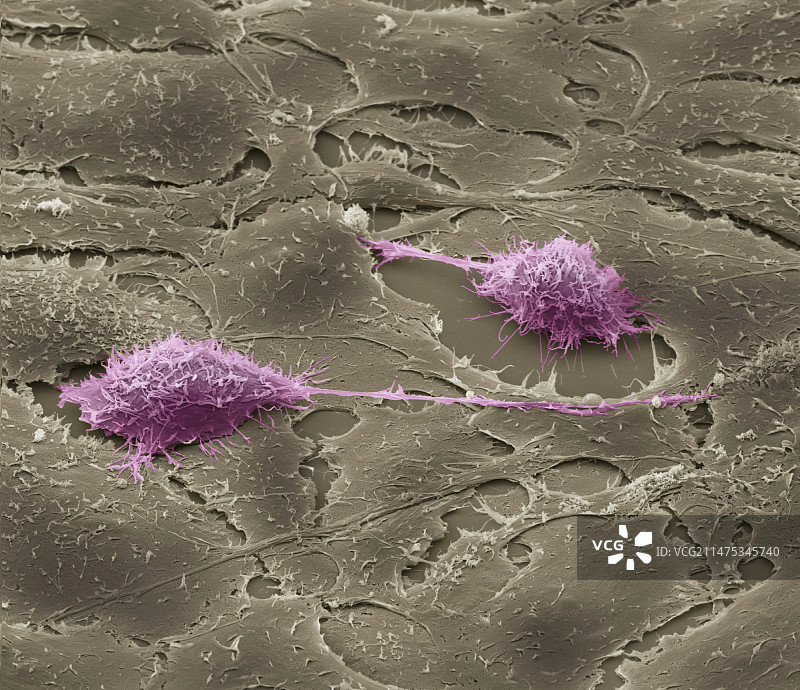 癌细胞培养，扫描电子显微镜图片素材