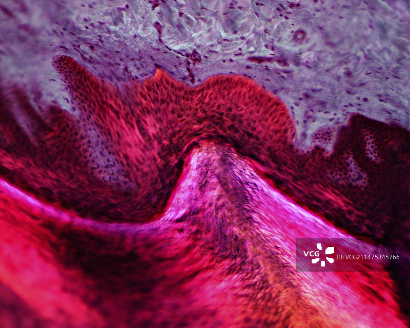 人类皮肤光学显微照片图片素材