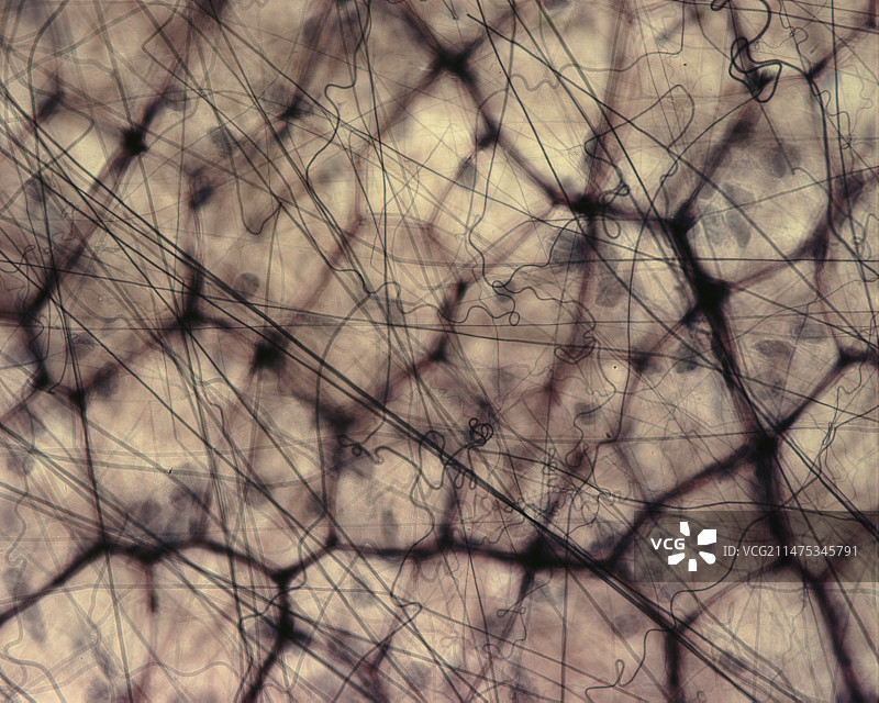 疏松结缔组织光显微照片图片素材