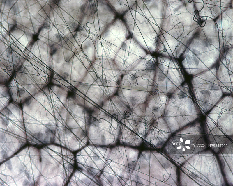 疏松结缔组织光显微照片图片素材
