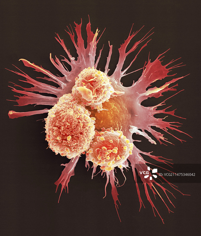 肺泡巨噬细胞，SEM图片素材