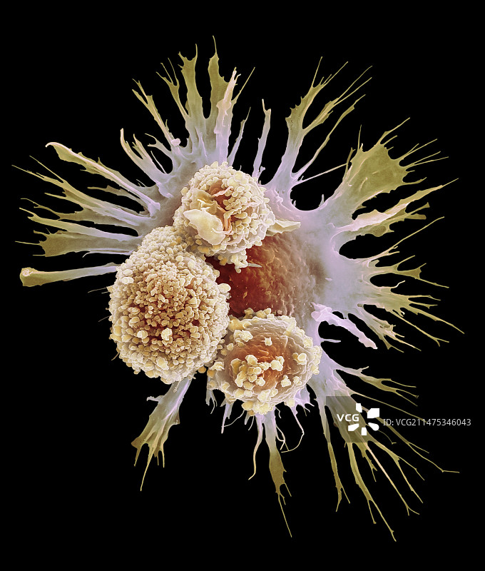 肺泡巨噬细胞，SEM图片素材