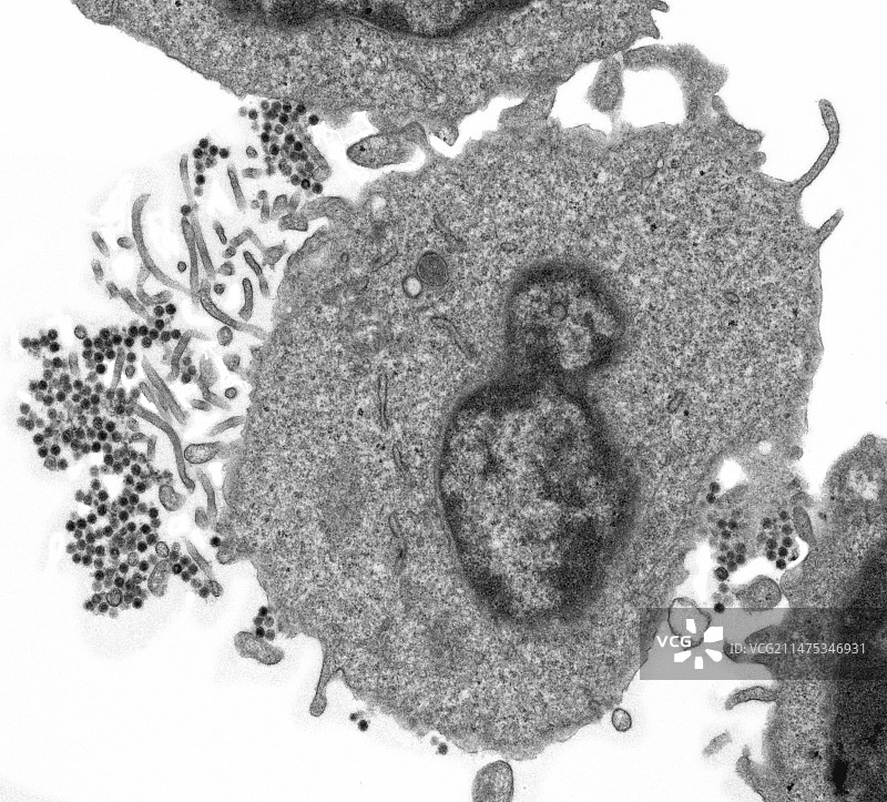 EB病毒，透射电子显微镜图片素材