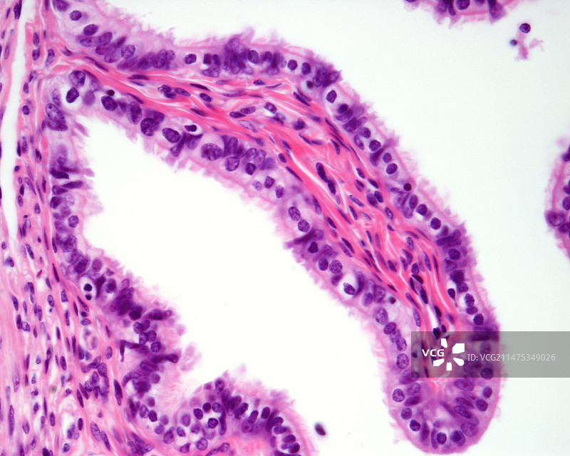输卵管粘膜，光学显微照片图片素材