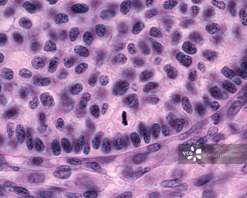 卵巢滤泡有丝分裂显微照片图片素材