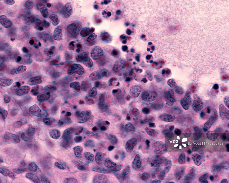 卵巢卵泡闭锁，光学显微照片图片素材