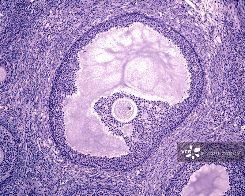 卵巢格拉夫卵泡显微照片图片素材