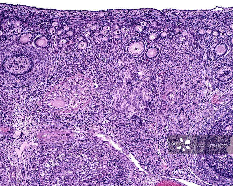 卵巢卵泡显微照片图片素材
