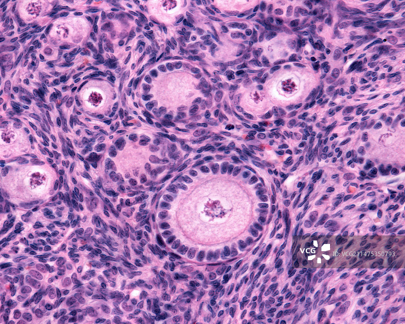 卵巢卵泡显微照片图片素材
