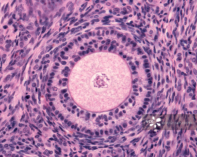 卵巢次级卵泡显微照片图片素材