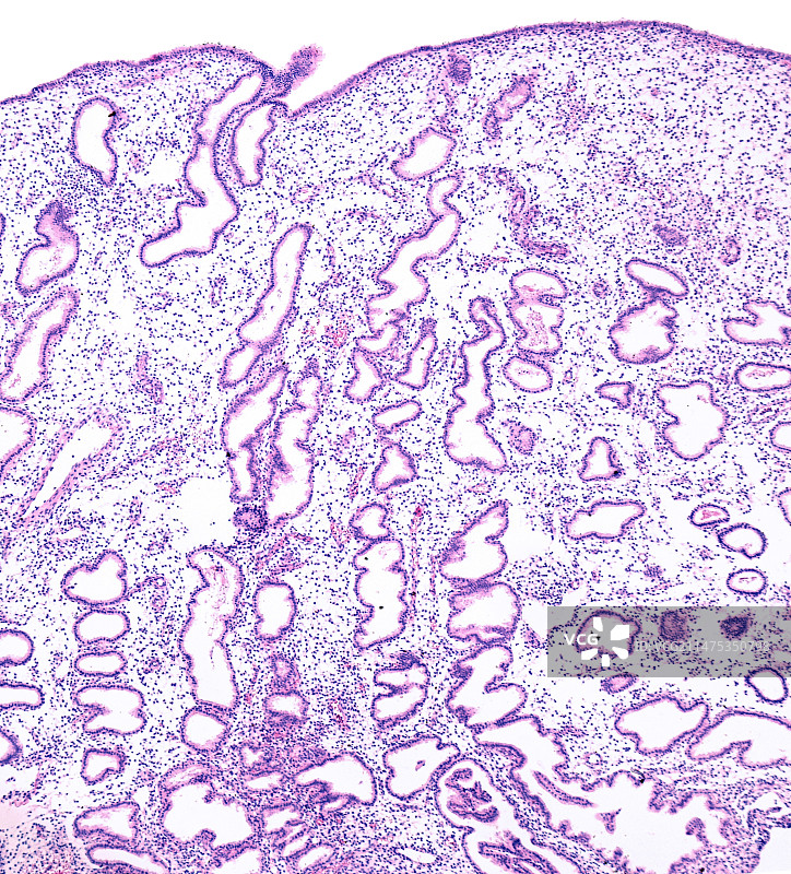 分泌期子宫内膜显微照片图片素材