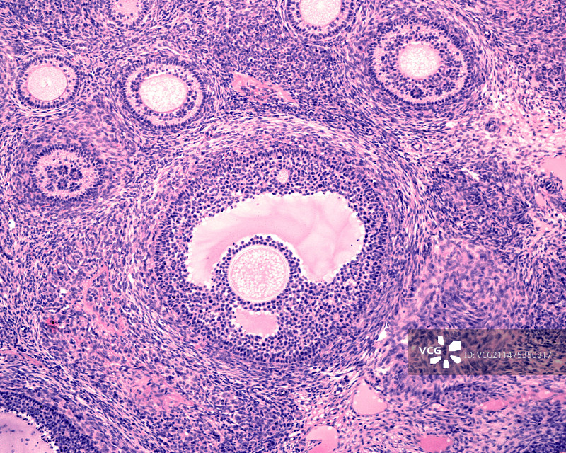 卵巢次级和三级卵泡显微照片图片素材