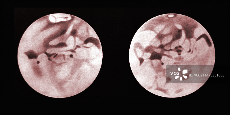 1924年至1926年火星表面变化插图图片素材