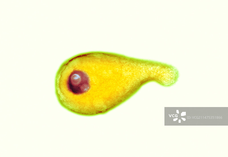 生殖支原体细菌，透射电子显微镜图像图片素材