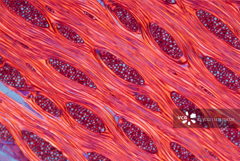英国榆树的横截面偏振光显微照片图片素材