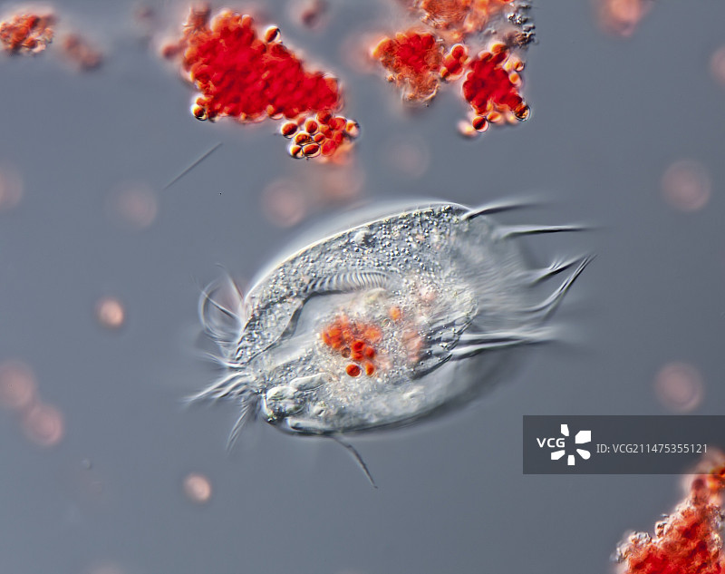 栉毛虫纤毛虫，光学显微照片图片素材