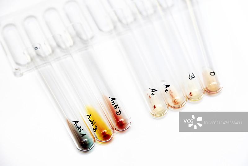 血型测试，O型Rh阴性图片素材