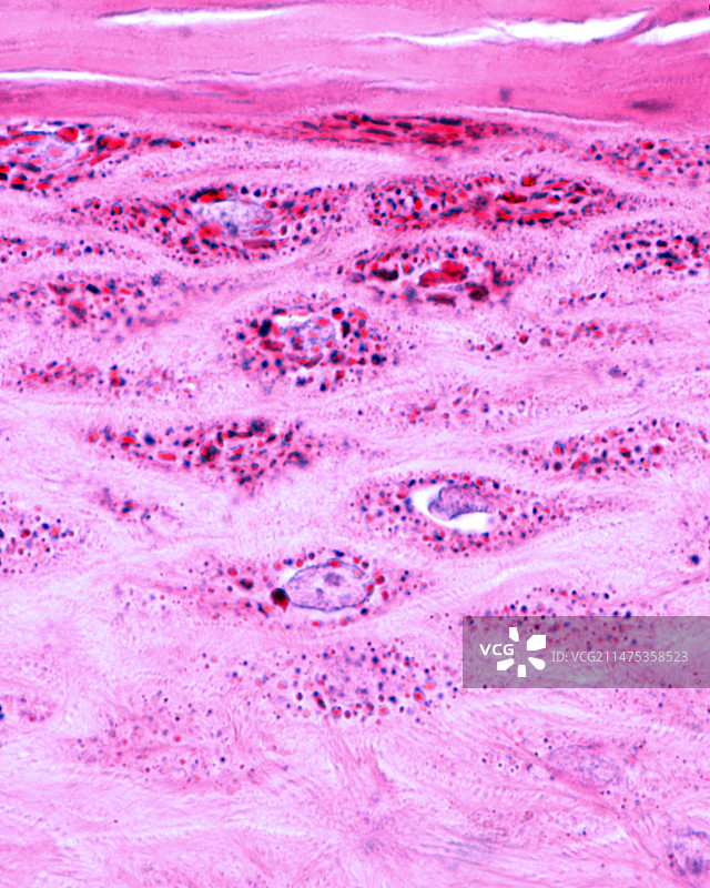 表皮颗粒层，光学显微照片图片素材