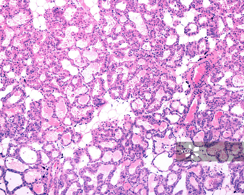 哺乳期乳腺组织光学显微照片图片素材
