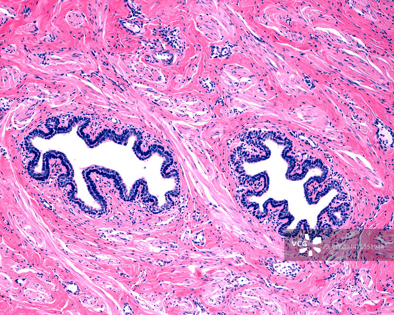 乳腺导管显微照片图片素材