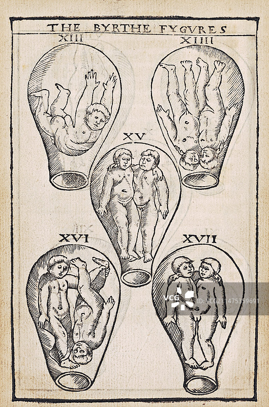 16世纪胎儿分娩姿势图片素材