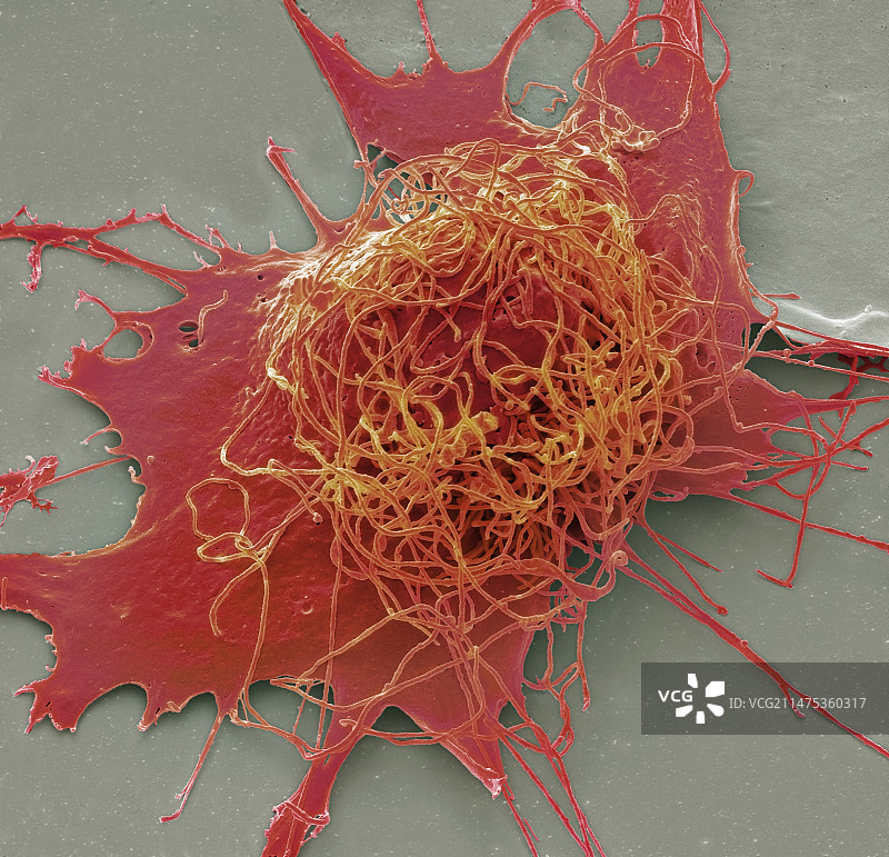 肝癌细胞 SEM图片素材