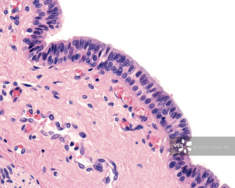 颌下唾液腺显微照片图片素材