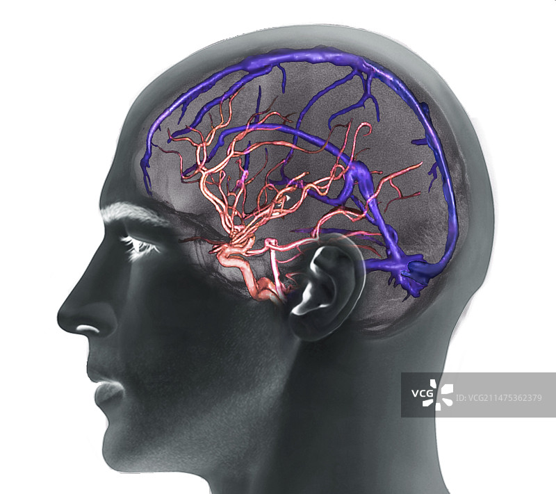 脑动脉和静脉窦3D CT血管造影图片素材