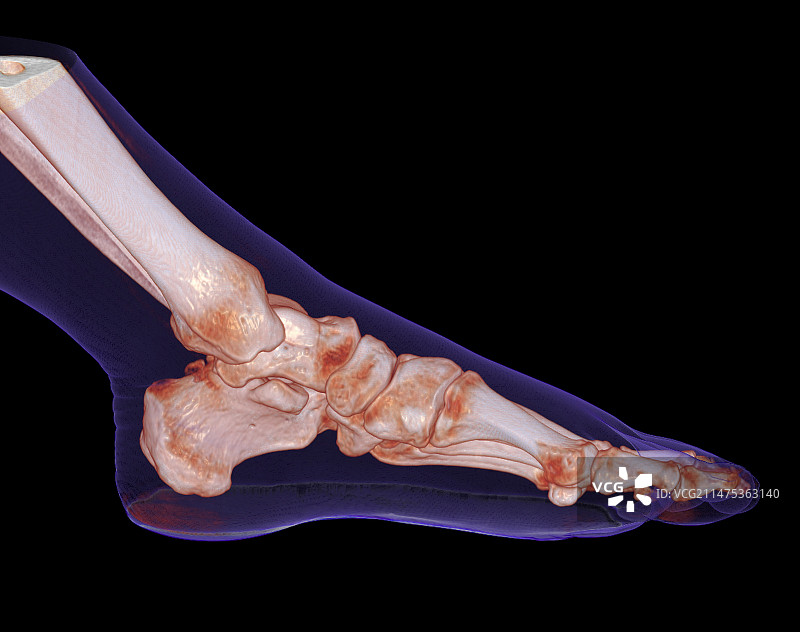 人的脚和踝关节3D CT扫描图片素材