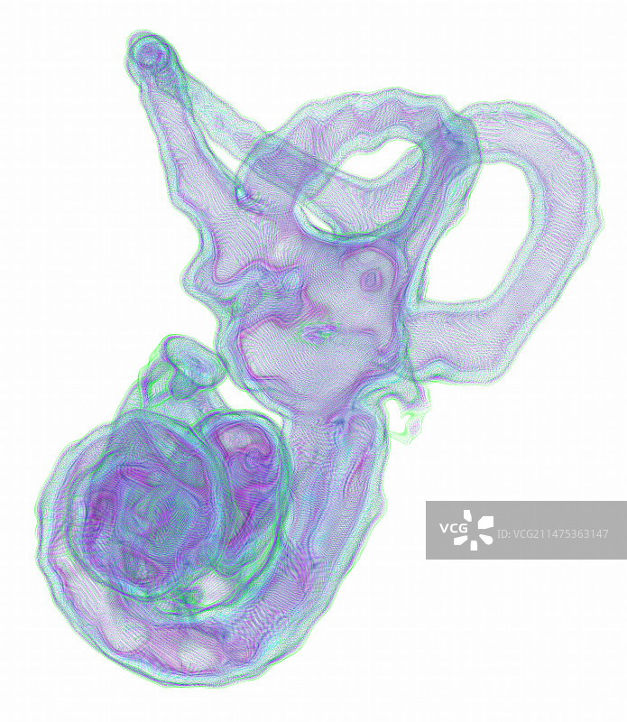 内耳结构3D核磁共振扫描图片素材