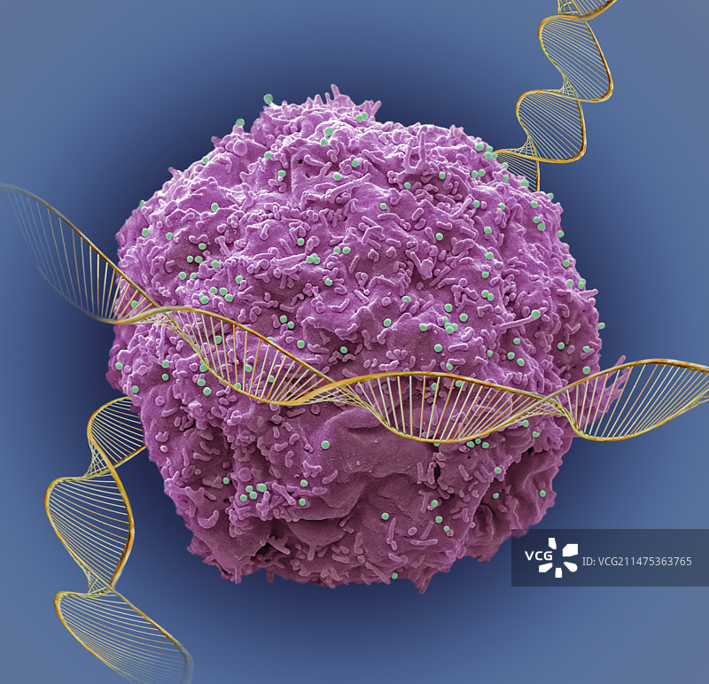 艾滋病毒感染与DNA概念合成图像图片素材