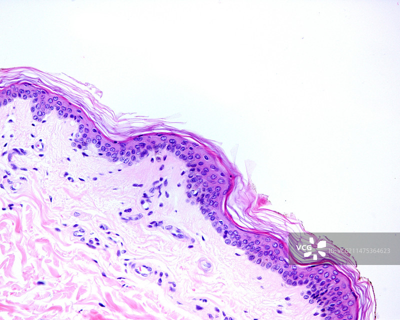皮肤，光学显微照片图片素材