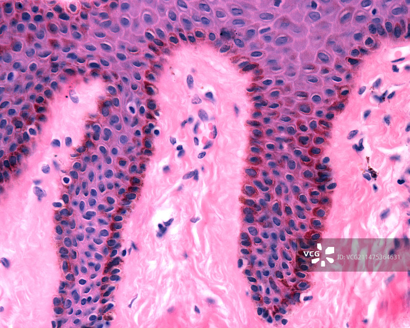 有色素沉淀的皮肤显微照片图片素材