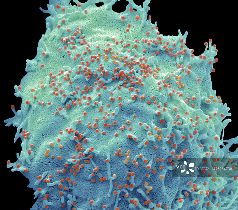 H1N1流感病毒株，扫描电子显微镜图片素材